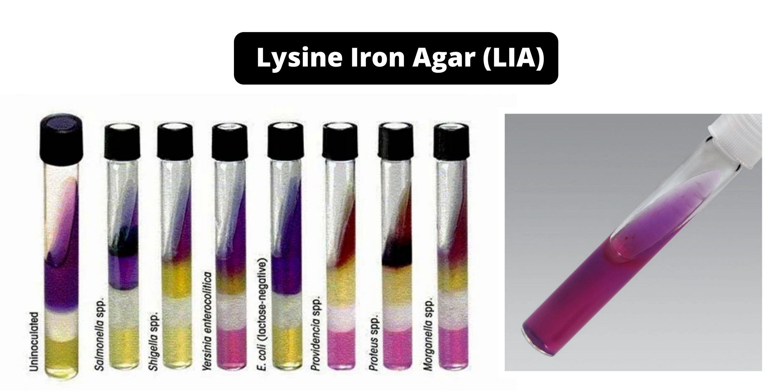 Lysine Iron Agar (LIA) Composition, Principle, Preparation, Results, Uses