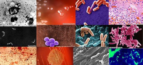 Most Infectious and Deadliest Diseases Caused By Bacteria