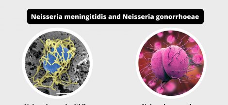 Differences between Neisseria meningitidis and Neisseria gonorrhoeae