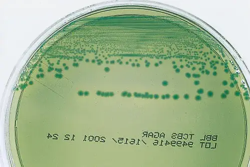 Vibrio parahaemolyticus on TCBS agar

