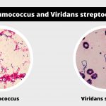 Differences between Pneumococcus and Viridans streptococci