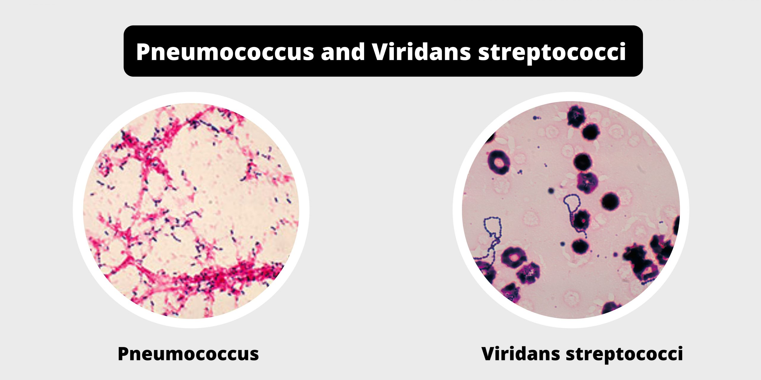 Differences between Pneumococcus and Viridans streptococci