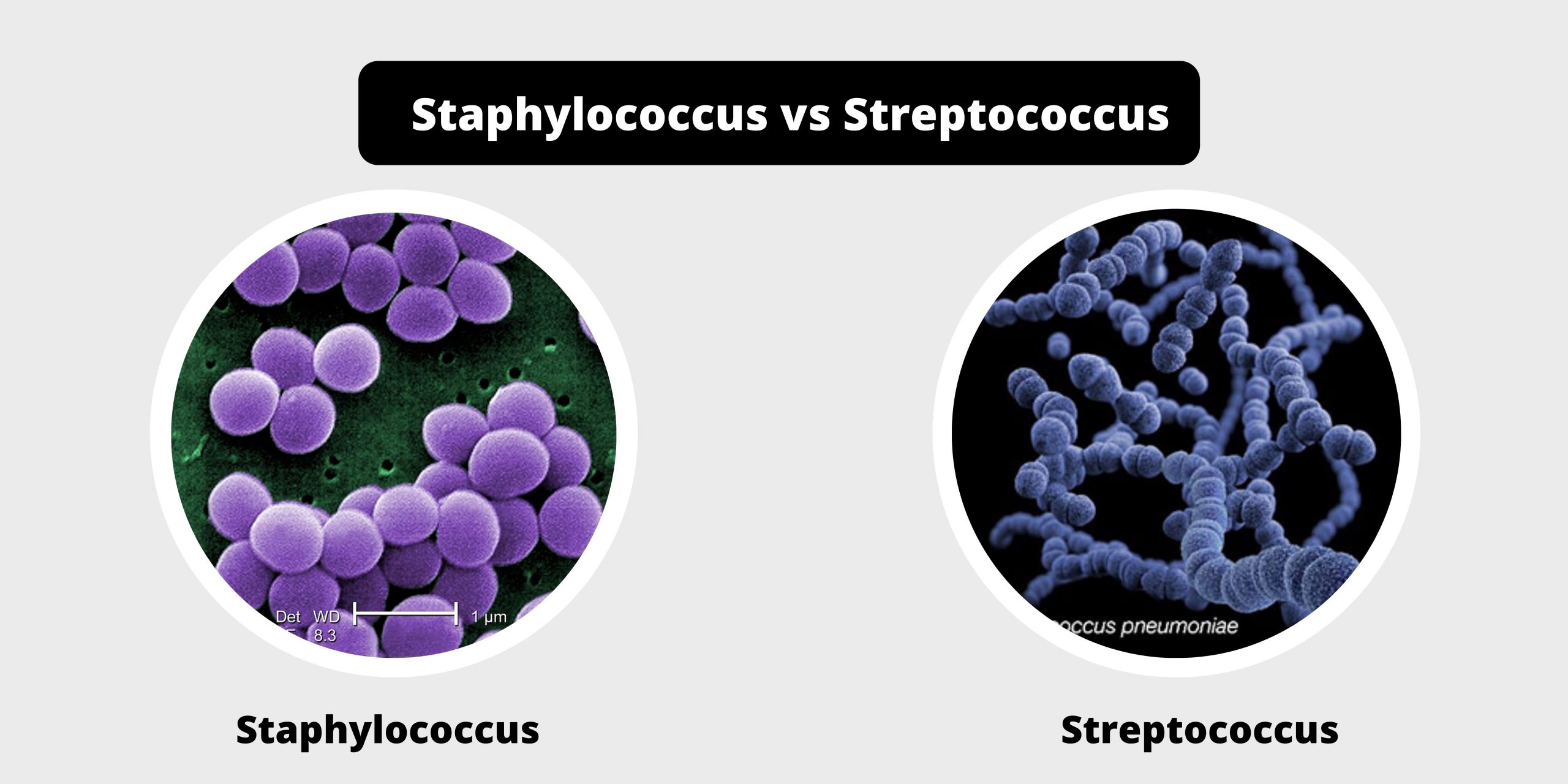 Стрептококки представители. Мультирезистентный стафилококк. Стафилококки генцианвиолет. Стафилококки и стрептококки. Стрептококки и стафилококки различия.