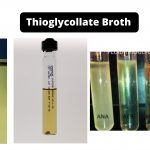 Thioglycollate Broth Composition, Principle, Preparation, Results, Uses