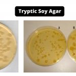 Tryptic Soy Agar Composition, Principle, Preparation, Results, Uses