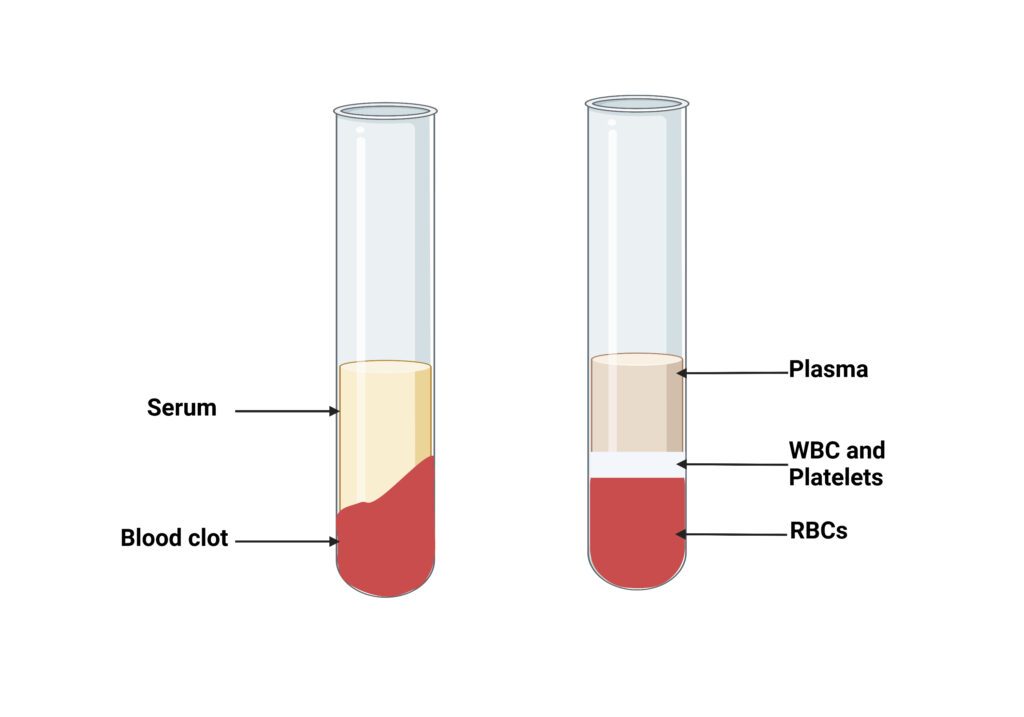 Differences between Serum and Plasma - Serum vs Plasma