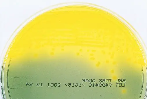 Vibrio cholerae on TCBS agar

