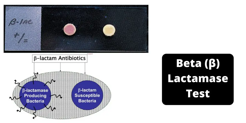 Beta (β) Lactamase Test Principle, Procedure, Results