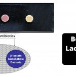 Beta (β) Lactamase Test Principle, Procedure, Results