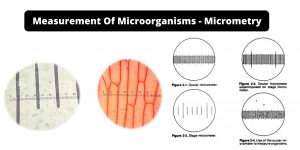 Measurement Of Microorganisms - Micrometry