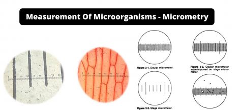 Measurement Of Microorganisms - Micrometry