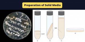 Preparation of Solid Media - agar deep tubes, Agar Slants, Plates