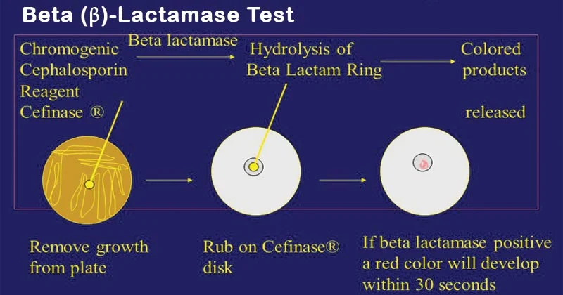 Result Interpretation of Beta Lactamase Test