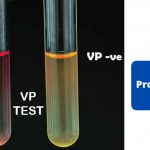 Voges Proskauer (VP) Test Principle, Procedure, Results, Uses