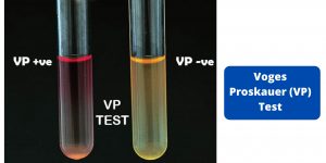 Voges Proskauer (VP) Test Principle, Procedure, Results, Uses