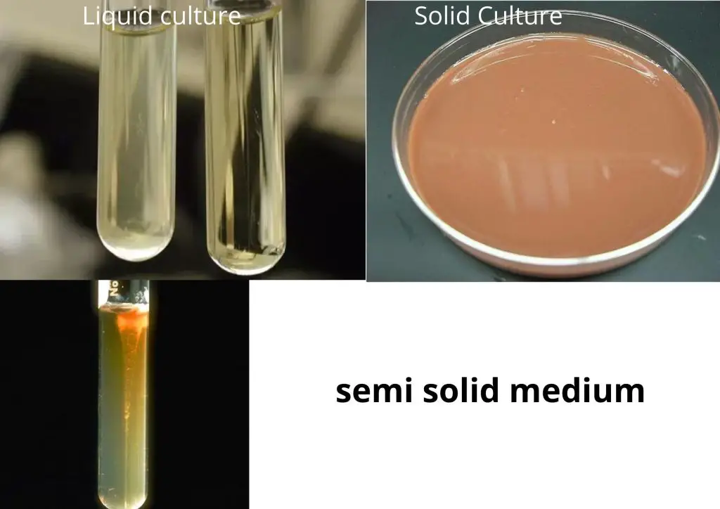 Classification of Bacterial Culture Media Based on Consistency 