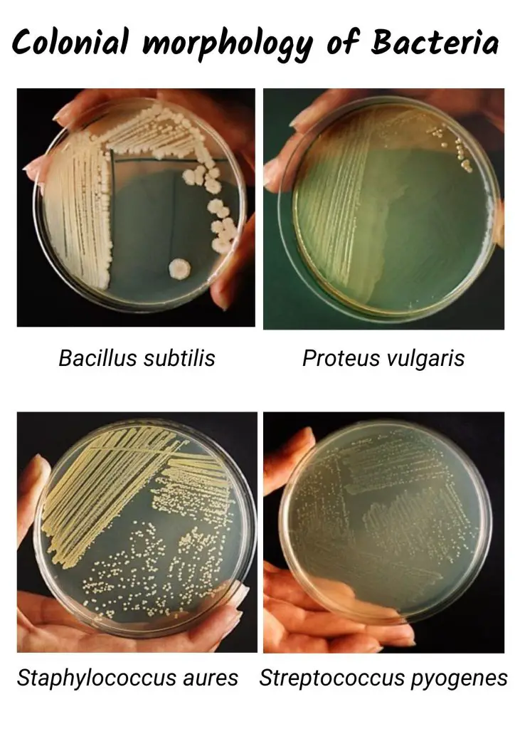Bacterial Colony Morphology Characteristics