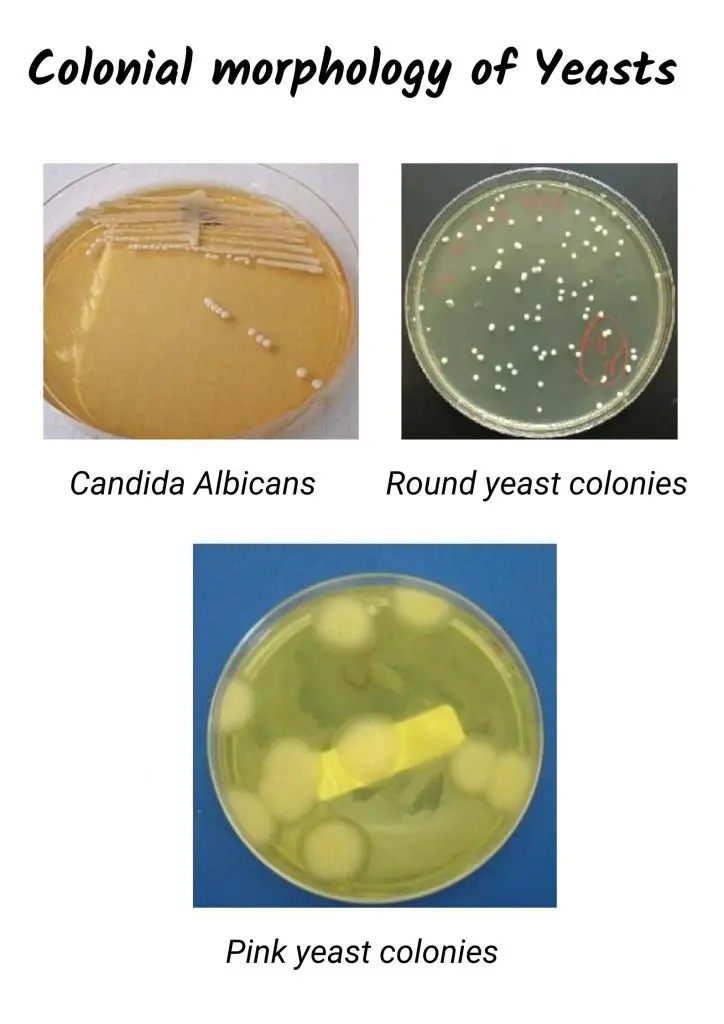Growth and colony characteristics of yeast
