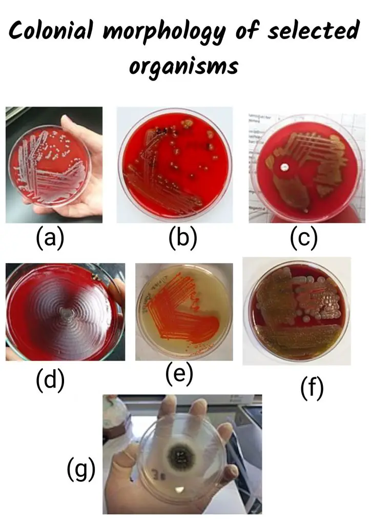 Bacterial Colony Morphology Examples