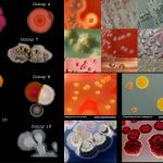 Colony Morphology of Bacteria and Examples