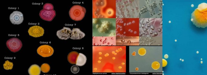 Colony Morphology of Bacteria and Examples