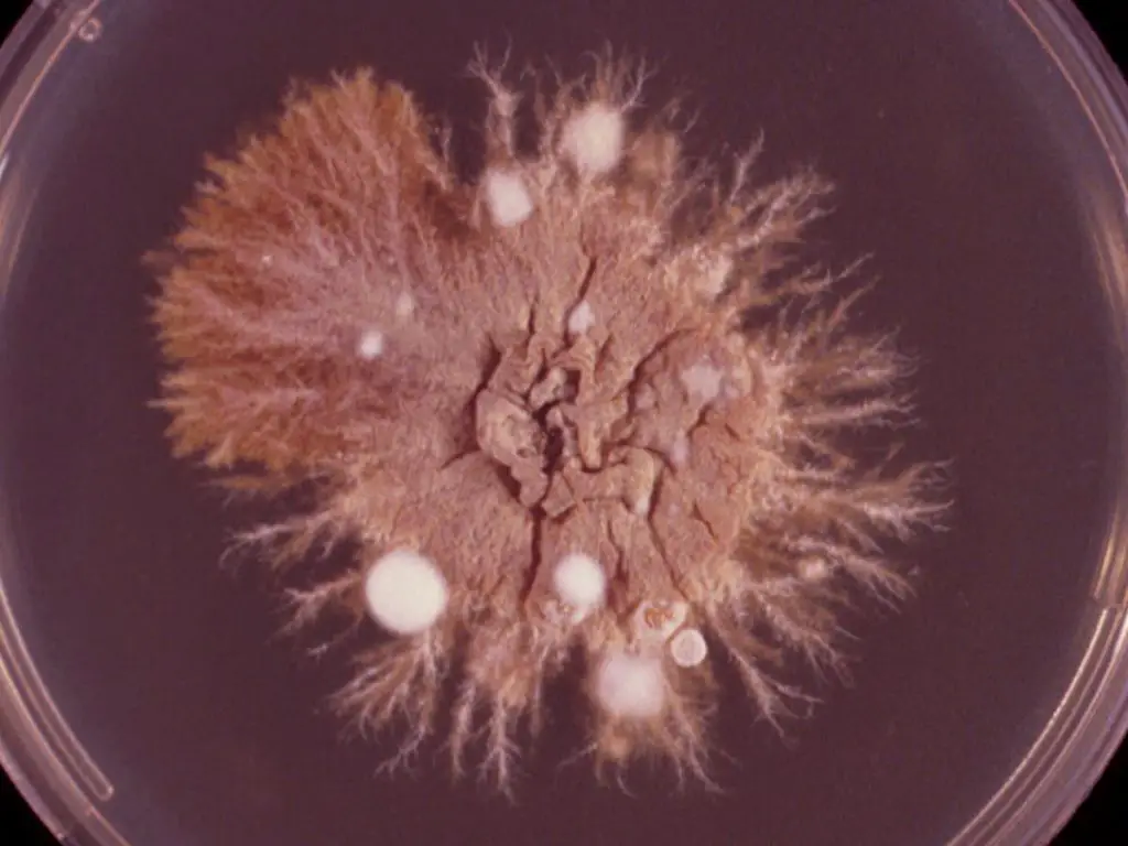 Morphology of Epidermophyton floccosum