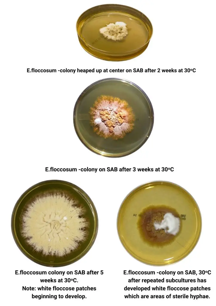 Macroscopic Morphology on petri dish