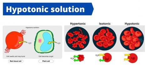 Hypotonic solution Definition, Examples