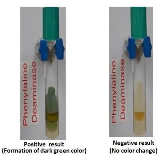 Result Interpretation of Phenylalanine Deaminase Test