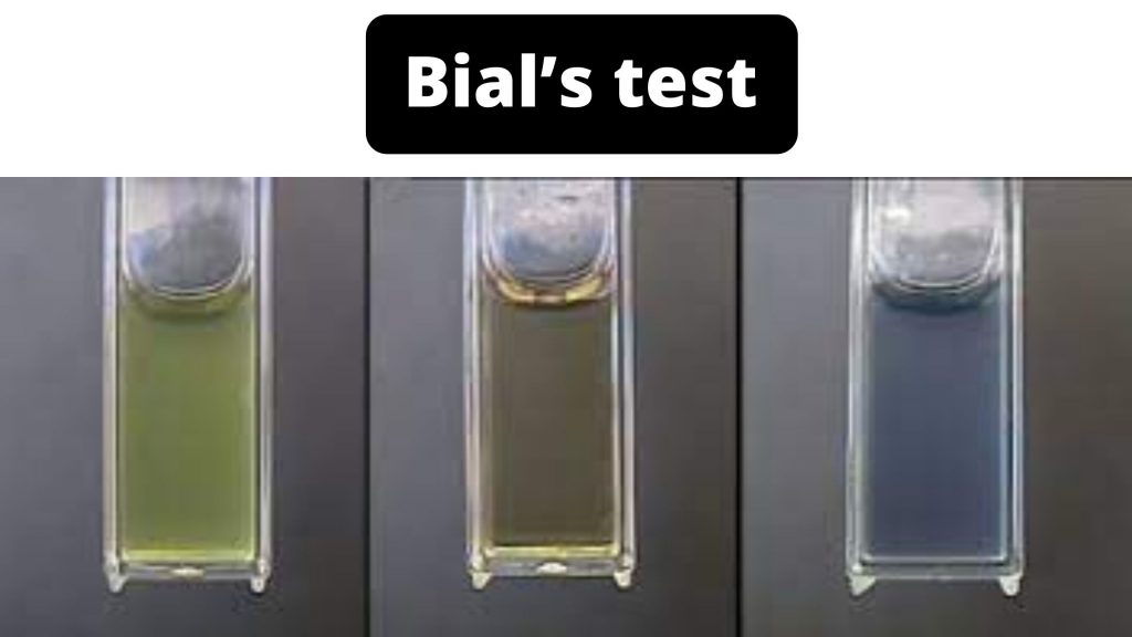 Bial’s test Principle, Objective, Procedure, Result