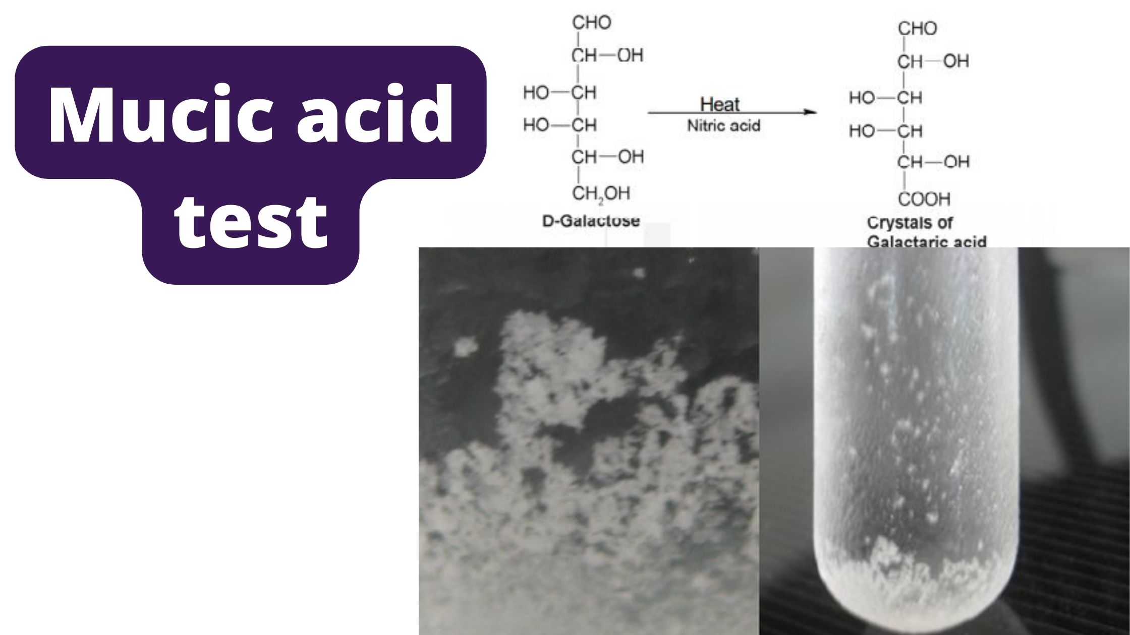 Mucic acid test - Principle, Procedure, Result