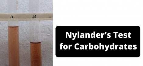 Nylander’s Test for Carbohydrates Principle, Procedure, Result