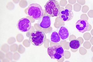 Total White Blood Cell (WBC) Count - Total Leucocyte Count (TLC)