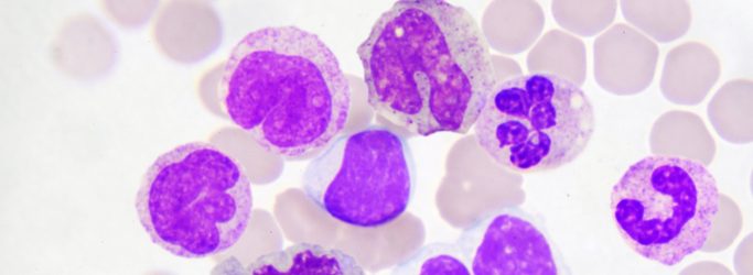 Total White Blood Cell (WBC) Count - Total Leucocyte Count (TLC)