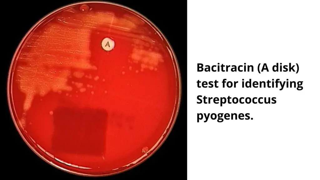 Bacitracin Susceptibility Test