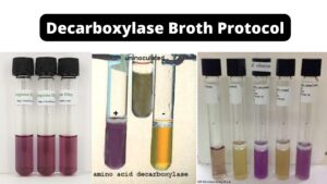 Decarboxylase Test Principle, Procedure, Results, Uses