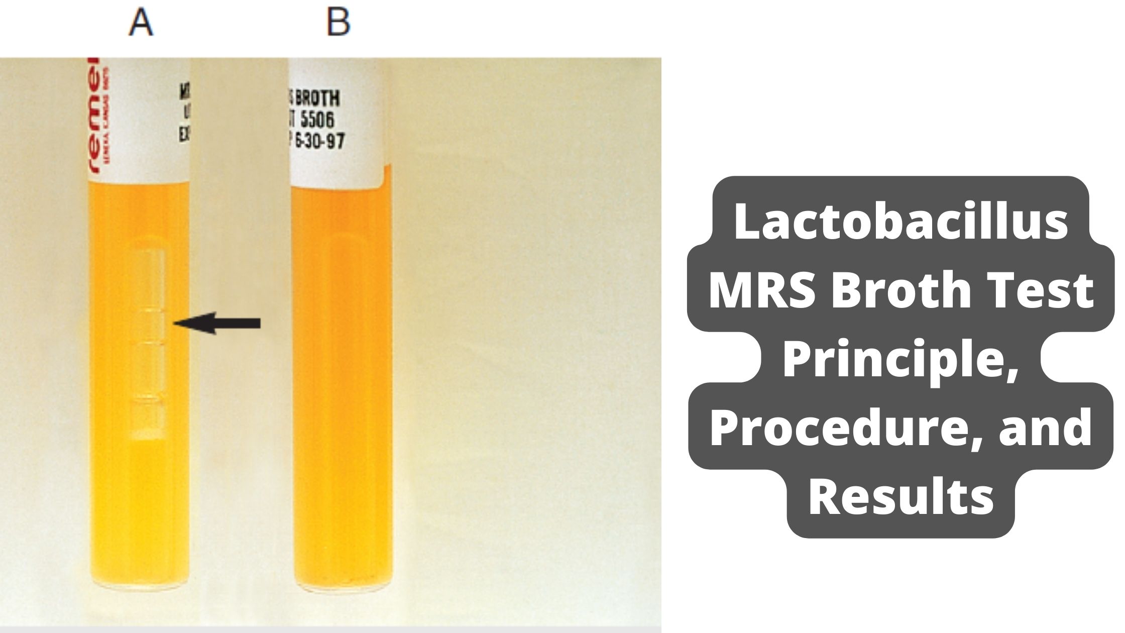 Lactobacillus MRS Broth Test Principle, Procedure, and Results
