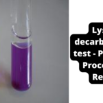 Lysine decarboxylase test - Principle, Procedure, Result