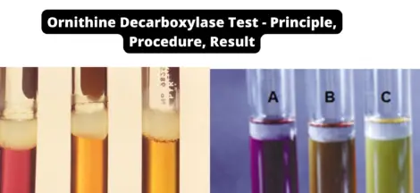 Ornithine Decarboxylase Test - Principle, Procedure, Result