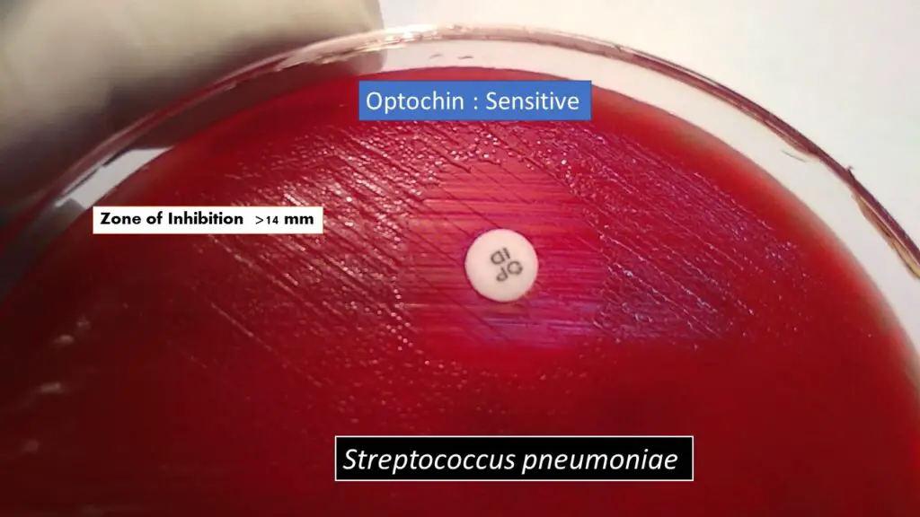 Result and Interpretation of Optochin Susceptibility Test