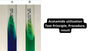 Acetamide utilization Test Principle, Procedure, result