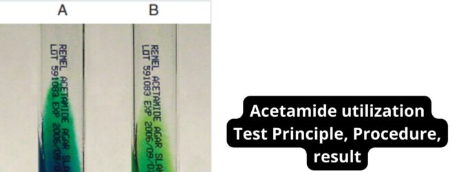 Acetamide utilization Test Principle, Procedure, result
