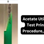 Acetate Utilization Test Principle, Procedure, Results