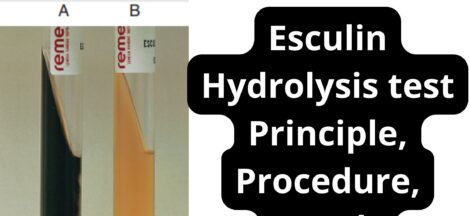Esculin Hydrolysis test Principle, Procedure, Result