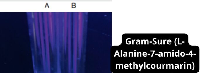 Gram-Sure (L-Alanine-7-amido-4-methylcourmarin) Test 