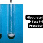 Hippurate Hydrolysis Test Principle, Procedure, Result