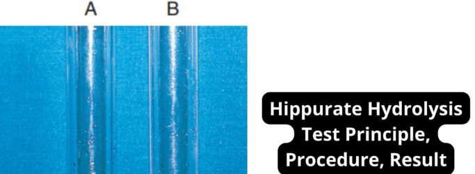 Hippurate Hydrolysis Test Principle, Procedure, Result