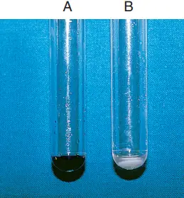 Interpretations and results of Hippurate Hydrolysis Test