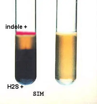 Result and Interpretation of Hydrogen Sulfide (H2S) Test
