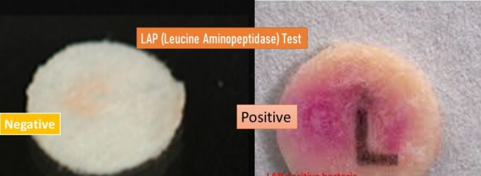 Leucine aminopeptidase (LAP) Test Principle, Procedure, Results